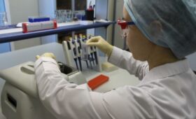 В Коми завершен первый этап проекта автоматизации лабораторий медицинских организаций республики